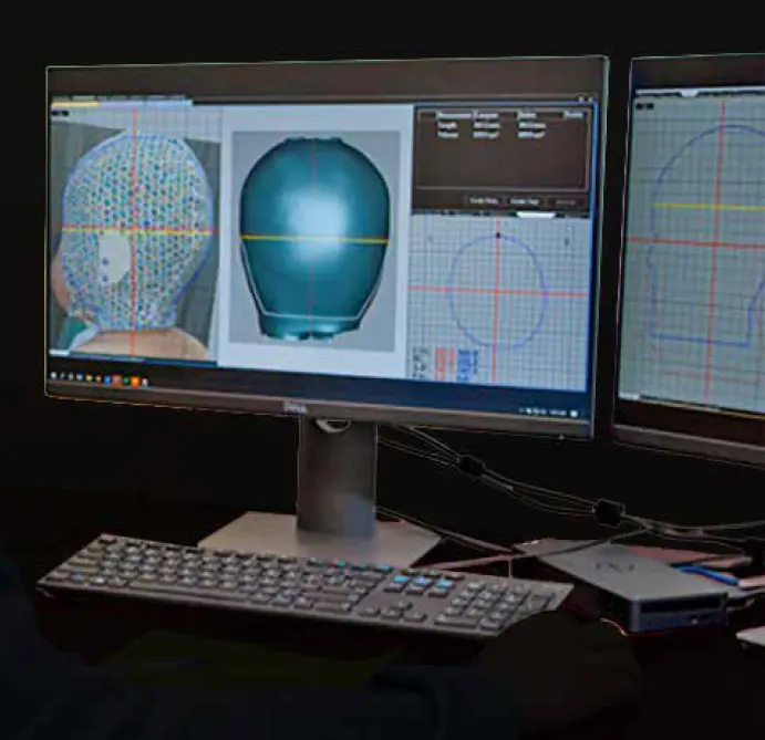 Cranial Scanning and Digital Orthotic Design photo