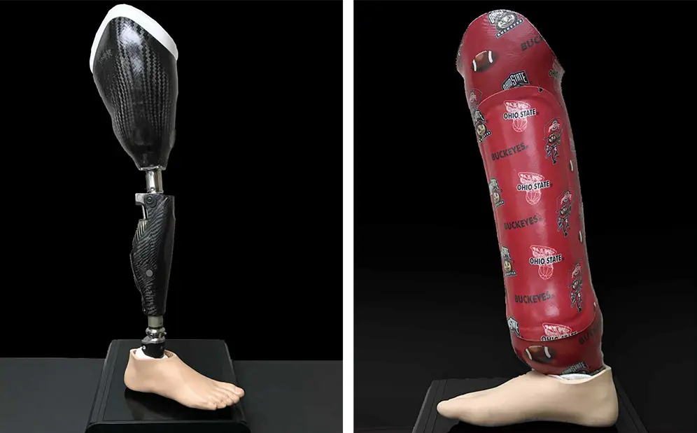 photo of prosthetics